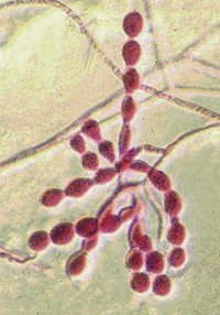 Fungal filaments inside an orchid root