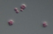 UAMH 11627 ascospores of Neosartorya laciniosa viewed by DIC microscopy